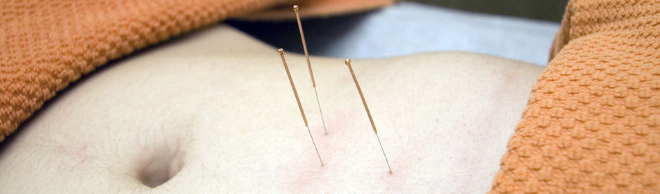 Accupuncture, Eastern Healing Arts in the Warminster, Bucks County PA area